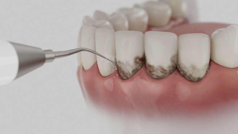 Trusted Teeth Cleaning And Checkup service in Wakefield, MI - Dentist Open Now